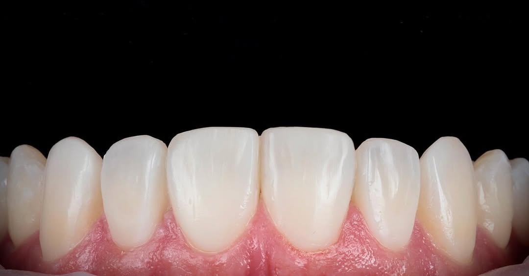 AESTHETIC DENTAL PHOTOGRAPHY with Dr Andrew & Dr Khalil
