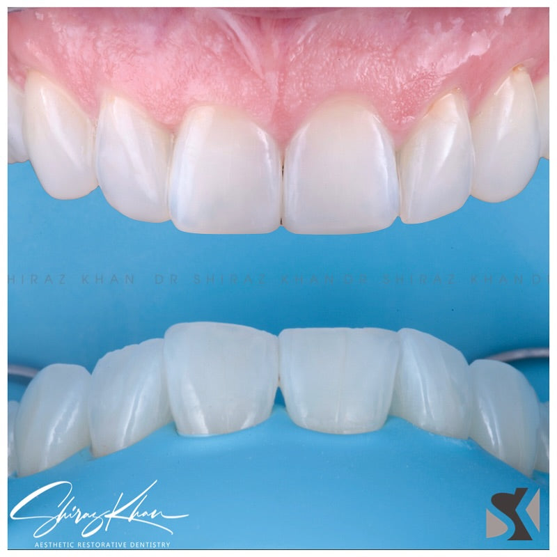 AESTHETIC DENTAL PHOTOGRAPHY with Dr Shiraz Khan